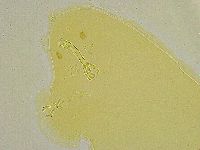 Macrobiotus islandicus image