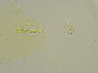 Macrobiotus islandicus image