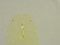 Macrobiotus islandicus image