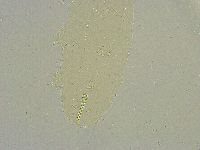 Macrobiotus islandicus image
