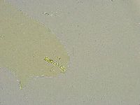 Macrobiotus islandicus image