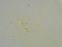 Macrobiotus islandicus image