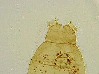 Macrobiotus islandicus image
