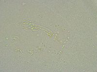 Mesobiotus liviae image