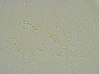 Mesobiotus liviae image