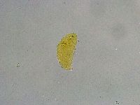 Mesobiotus liviae image
