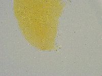Mesobiotus liviae image