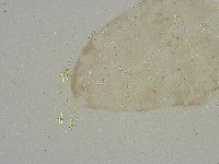 Mesobiotus liviae image