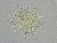 Macrobiotus islandicus image