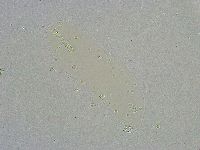 Mesobiotus liviae image