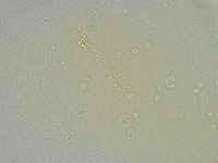 Mesobiotus liviae image