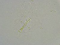 Mesobiotus liviae image