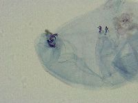 Mesobiotus liviae image