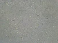 Mesobiotus liviae image