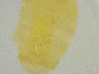 Mesobiotus liviae image