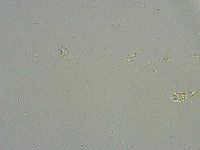 Mesobiotus liviae image
