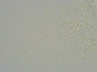 Mesobiotus liviae image