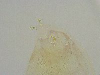 Mesobiotus liviae image