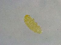 Mesobiotus liviae image