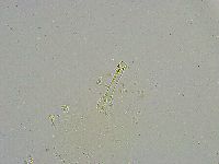 Mesobiotus liviae image