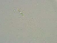 Mesobiotus liviae image