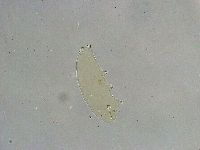 Macrobiotus islandicus image