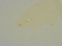 Macrobiotus islandicus image