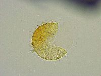 Macrobiotus islandicus image