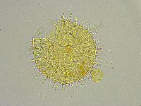 Macrobiotus islandicus image