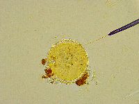 Macrobiotus islandicus image