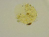 Macrobiotus islandicus image