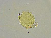 Macrobiotus islandicus image