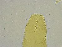 Macrobiotus islandicus image