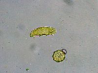 Macrobiotus islandicus image