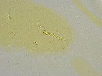 Macrobiotus islandicus image