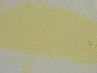 Macrobiotus islandicus image