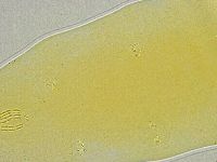 Mesobiotus liviae image