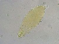 Mesobiotus liviae image