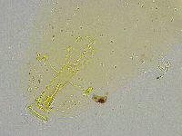 Mesobiotus liviae image