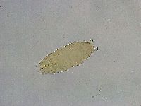 Mesobiotus liviae image