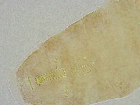Mesobiotus liviae image