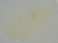 Mesobiotus liviae image