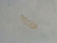 Mesobiotus liviae image