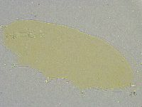 Mesobiotus liviae image