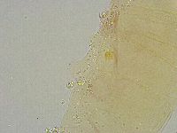 Mesobiotus liviae image