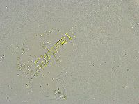 Mesobiotus liviae image