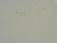 Mesobiotus liviae image