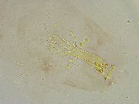 Mesobiotus liviae image