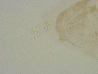 Mesobiotus liviae image