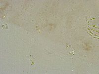 Mesobiotus liviae image